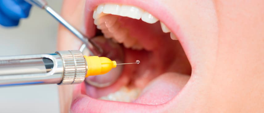 Explorando las Diferencias entre distintos tipos de Anestesias Dentales anestesia dental